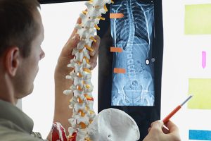 راههای تشخیص انحرافات ستون فقرات