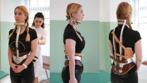 ارتز ستون فقرات