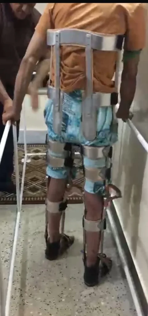 بریس قطع نخاع