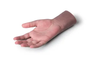 پروتز زیبایی دست