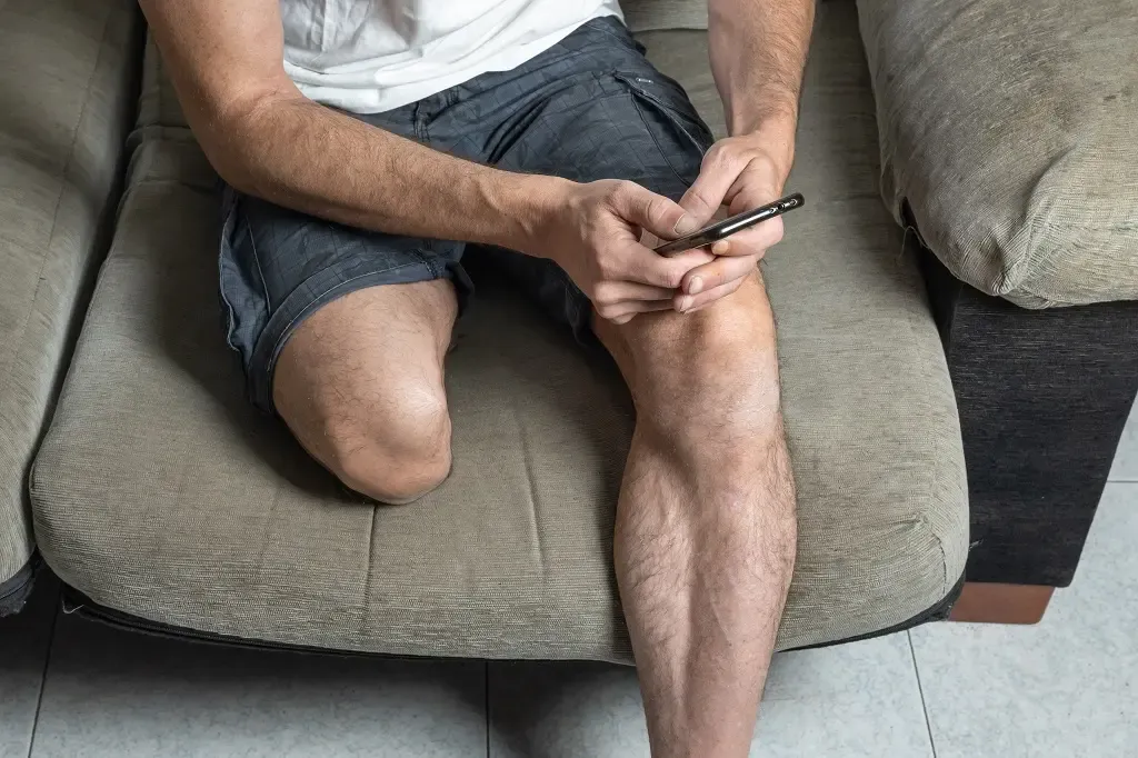 آمپوتاسیون